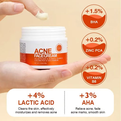 🔥Acne Mark Repair Cream — Specially formulated for teenagers and adults with sensitive skin; effectively fades acne marks and clears blemishes. Fragrance-free and paraben-free.😮