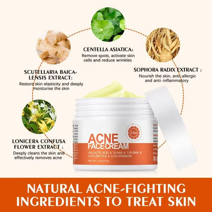 🔥Acne Mark Repair Cream — Specially formulated for teenagers and adults with sensitive skin; effectively fades acne marks and clears blemishes. Fragrance-free and paraben-free.😮
