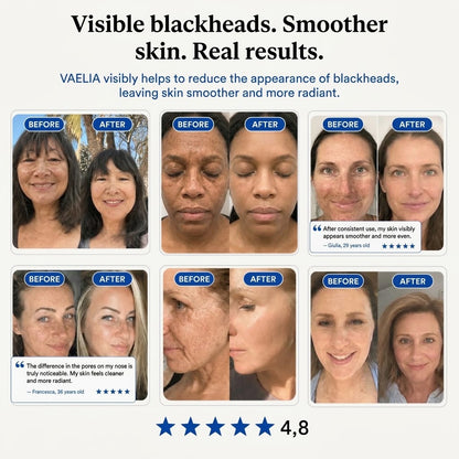 😩 Visible Pores & Stubborn Blackheads? Get Smoother-Looking Skin in Just 14 Days — Guaranteed Results! ✨