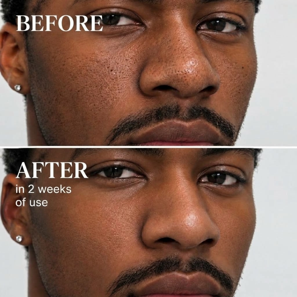 😩 Visible Pores & Stubborn Blackheads? Get Smoother-Looking Skin in Just 14 Days — Guaranteed Results! ✨