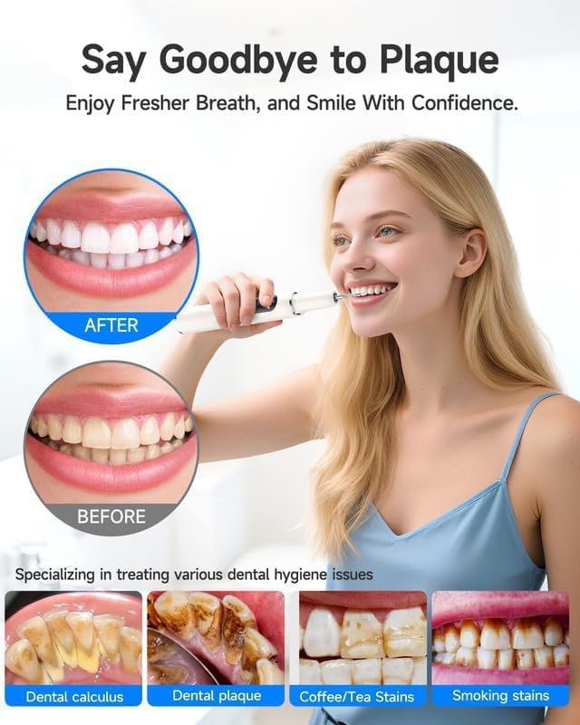 Electric Oral Cleaning Tool with LED Light