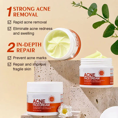 🔥Acne Mark Repair Cream — Specially formulated for teenagers and adults with sensitive skin; effectively fades acne marks and clears blemishes. Fragrance-free and paraben-free.😮