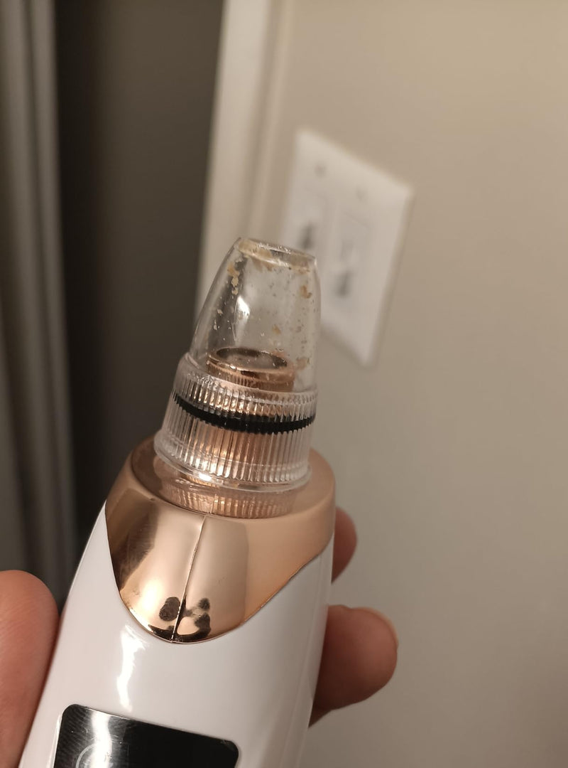 Customer photo of blackhead removal machine