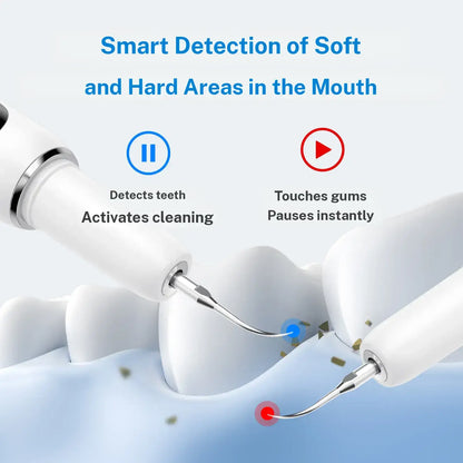 🎁Ultrasonic Plaque and Tartar Remover, Professional Teeth Cleaning Kit (7-Piece Set) — Safe and Gentle💎