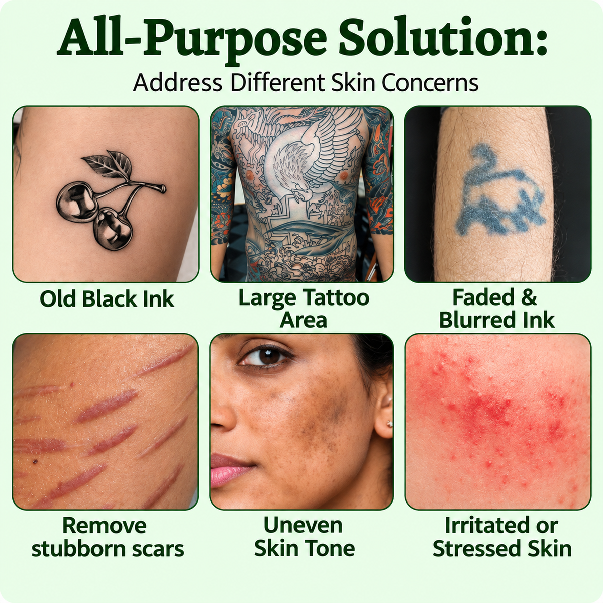 🌿 Tattoo Fading Spray – Gentle At-Home Care for Unwanted Ink ✨