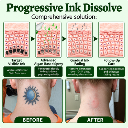 🌿 Tattoo Fading Spray – Gentle At-Home Care for Unwanted Ink ✨