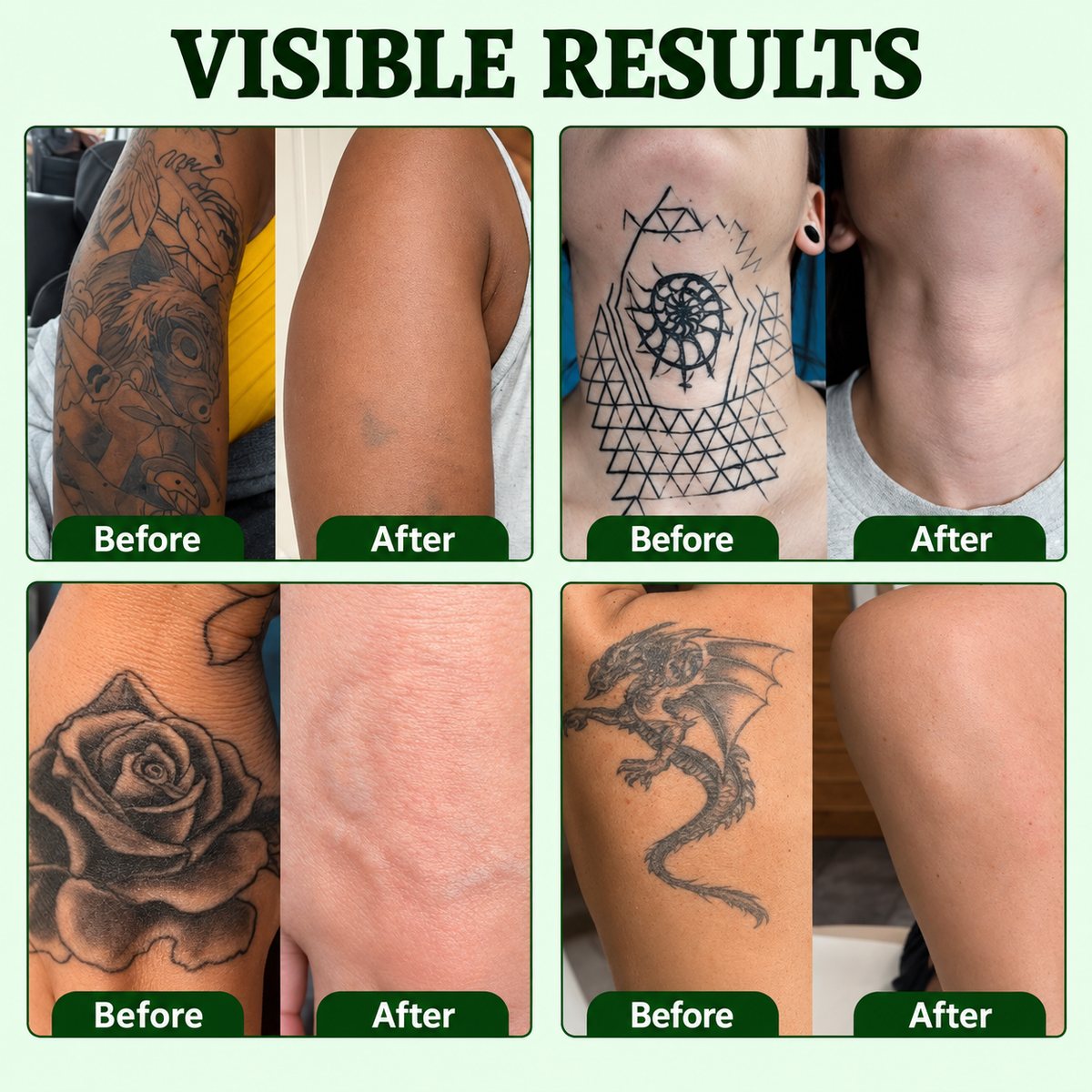 🌿 Tattoo Fading Spray – Gentle At-Home Care for Unwanted Ink ✨