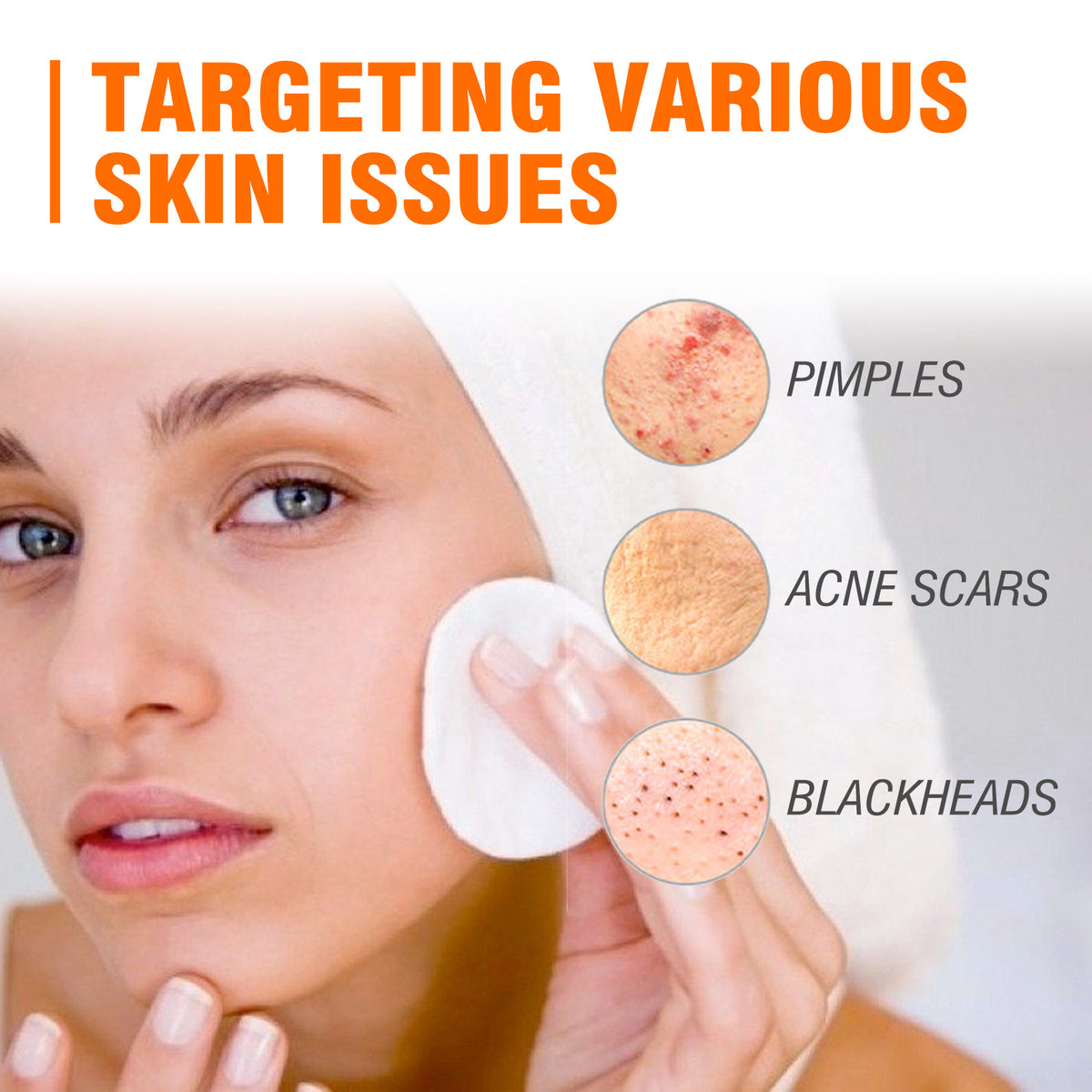 🔥Acne Mark Repair Cream — Specially formulated for teenagers and adults with sensitive skin; effectively fades acne marks and clears blemishes. Fragrance-free and paraben-free.😮
