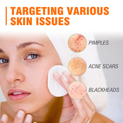 🔥Acne Mark Repair Cream — Specially formulated for teenagers and adults with sensitive skin; effectively fades acne marks and clears blemishes. Fragrance-free and paraben-free.😮