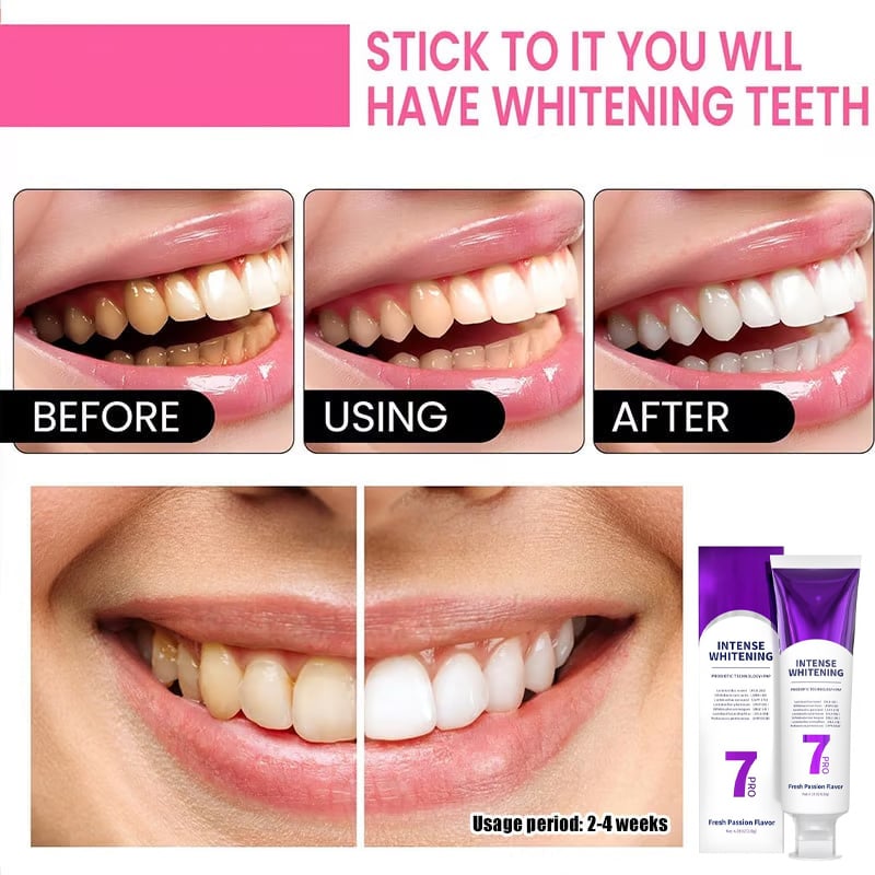 🔥BUY 1 FREE 1🔥New 7-Pro Intensive Toothpaste | Upgraded Purple Formula with 7 Probiotics | Deep Enamel Repair & Long-Lasting Freshness#dealsforyoudays
