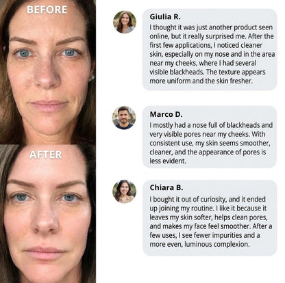 😩 Visible Pores & Stubborn Blackheads? Get Smoother-Looking Skin in Just 14 Days — Guaranteed Results! ✨