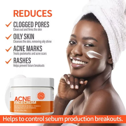 🔥Acne Mark Repair Cream — Specially formulated for teenagers and adults with sensitive skin; effectively fades acne marks and clears blemishes. Fragrance-free and paraben-free.😮