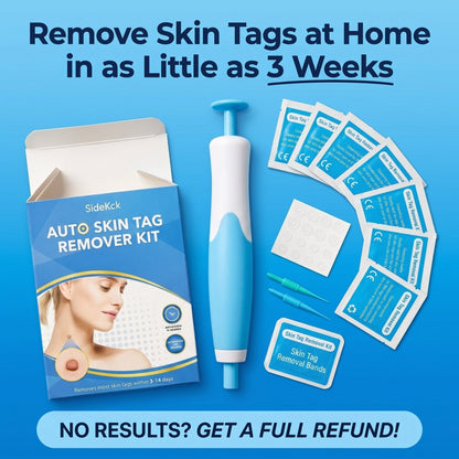 7-Day Skin Tag Remover Kit