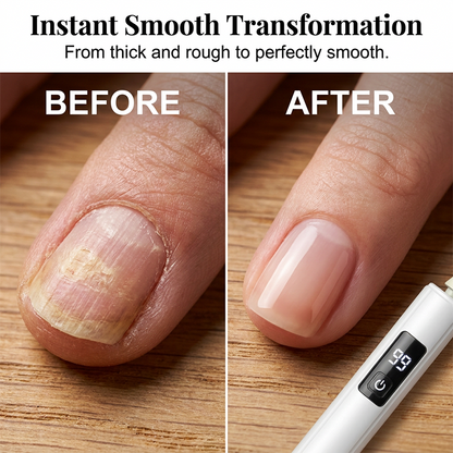💅 Tired of Struggling With Thick, Uneven Nails? 😩 One Powerful Electric Nail Polisher Smooths, Shapes & Buffs With Ease! ✨💎