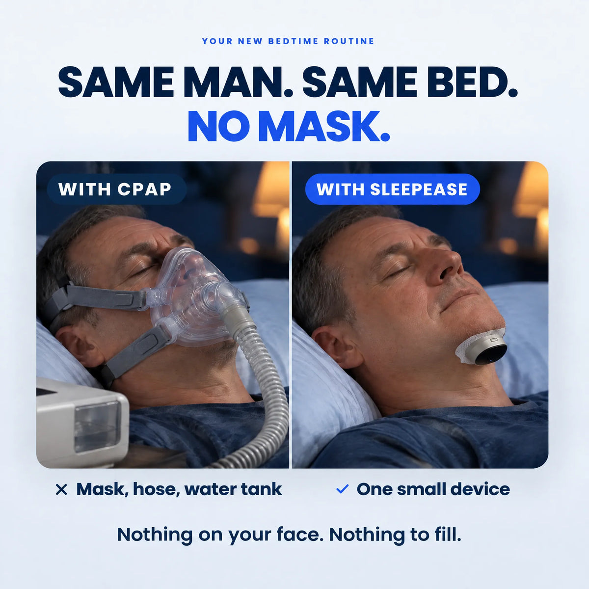 ⏰Year-End Sale-Wearable Anti-Snoring Device